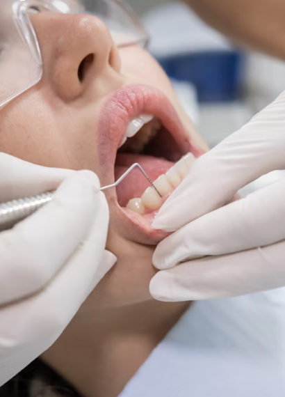 Periodoncia en Bilbao